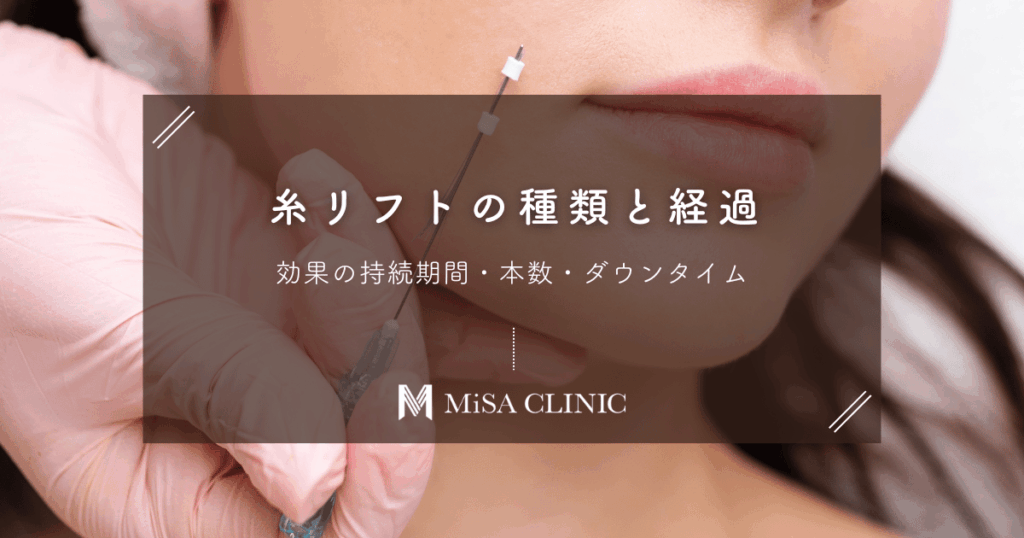 糸リフト（スレッドリフト）の種類と経過｜効果の持続期間・本数・ダウンタイム