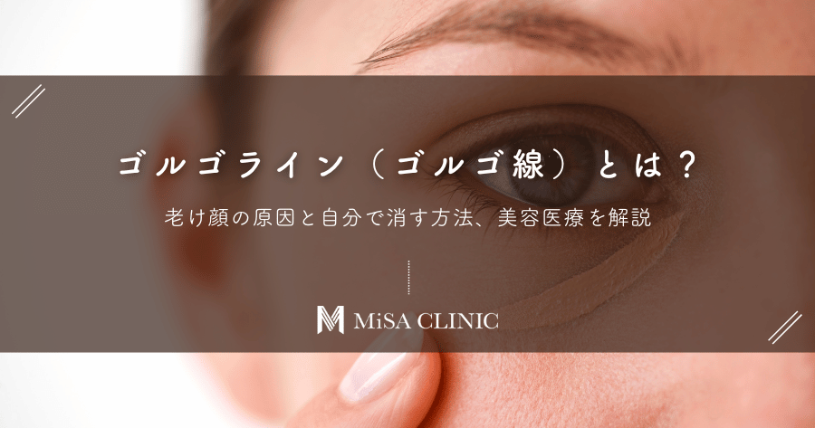 ゴルゴライン（ゴルゴ線）とは？老け顔の原因と自分で消す方法、美容医療を解説