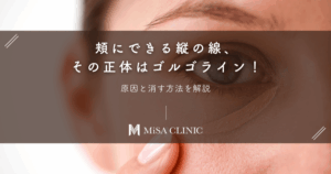頬にできる縦の線、その正体はゴルゴライン!原因と消す方法を解説