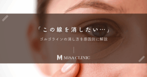 「この線を消したい…」ゴルゴラインの消し方を原因別に解説