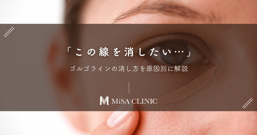 「この線を消したい…」ゴルゴラインの消し方を原因別に解説