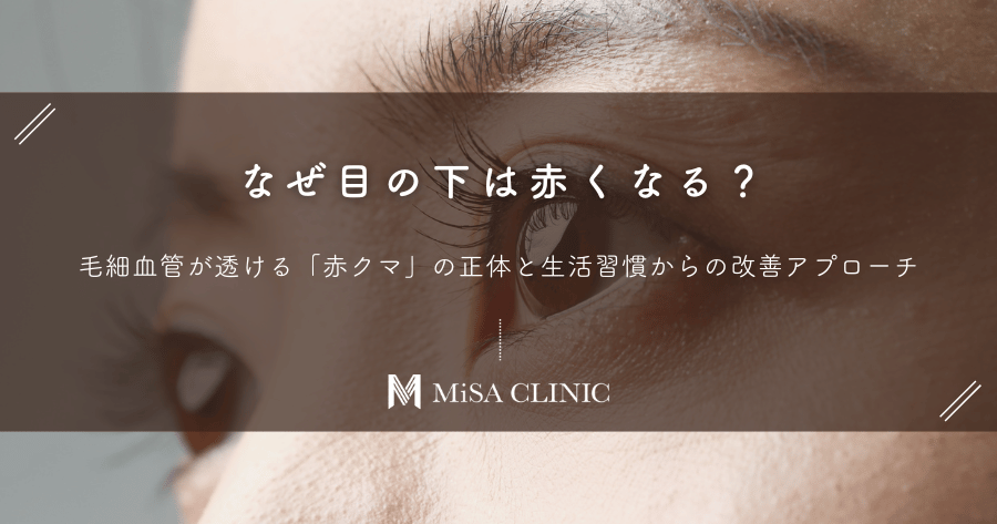 なぜ目の下は赤くなる?毛細血管が透ける「赤クマ」の正体と生活習慣からの改善アプローチ
