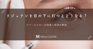 リジュランを目の下に打つとどうなる?クマ・小じわへの効果と経過を解説