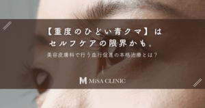 【重度のひどい青クマ】はセルフケアの限界かも。美容皮膚科で行う血行促進の本格治療とは？