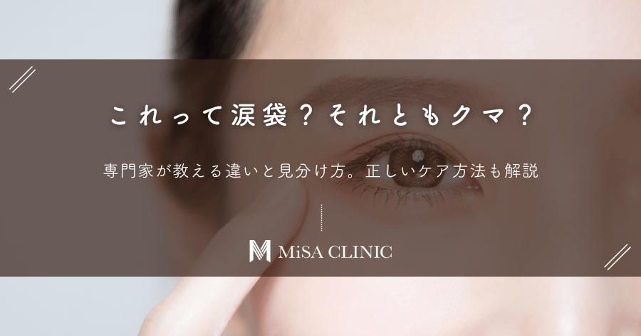 これって涙袋？それともクマ？専門家が教える違いと見分け方。正しいケア方法も解説