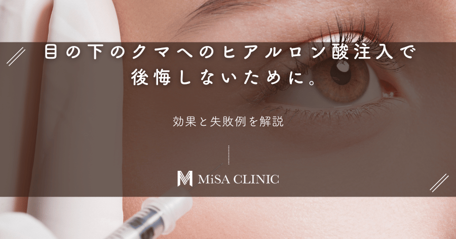目の下のクマへのヒアルロン酸注入で後悔しないために。効果と失敗例を解説