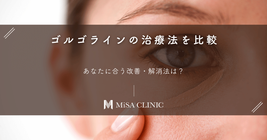ゴルゴラインの治療法を比較|あなたに合う改善・解消法は?