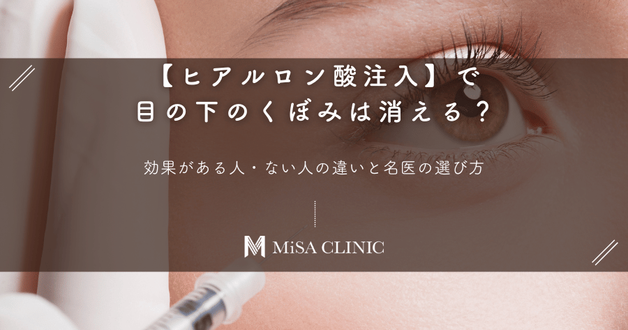 【ヒアルロン酸注入】で目の下のくぼみは消える？効果がある人・ない人の違いと名医の選び方