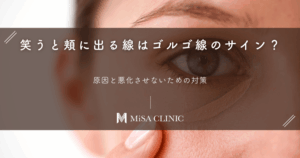 笑うと頬に出る線はゴルゴ線のサイン？原因と悪化させないための対策