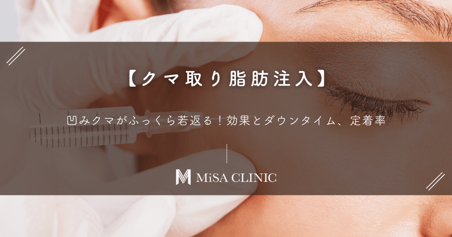 【クマ取り脂肪注入】凹みクマがふくら若返る！効果とダウンタイム、定着率