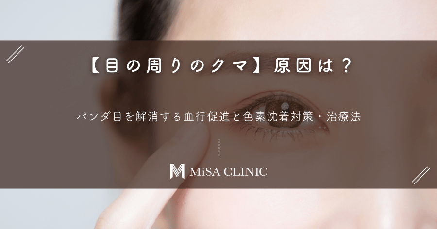 【目の周りのクマ】原因は？パンダ目を解消する血行促進と色素沈着対策・治療法