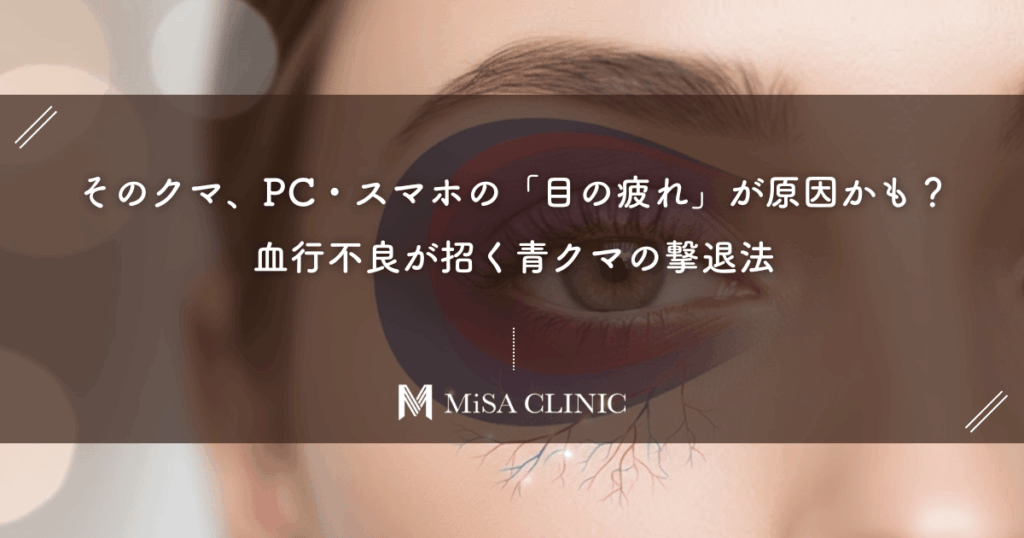 そのクマ、PC・スマホの「目の疲れ」が原因かも？血行不良が招く青クマの撃退法