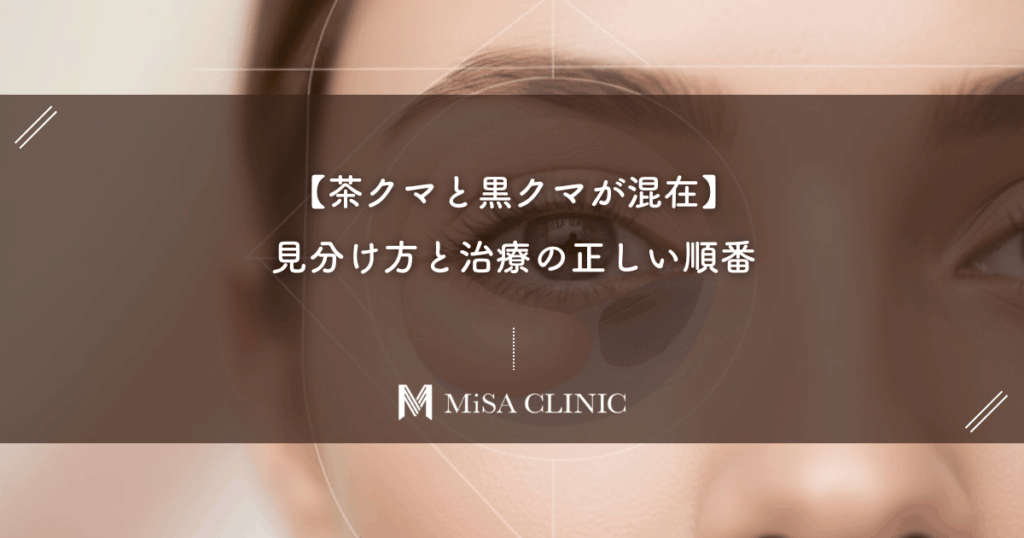 【茶クマと黒クマが混在】あなたのクマは混合タイプ？見分け方と治療の正しい順番