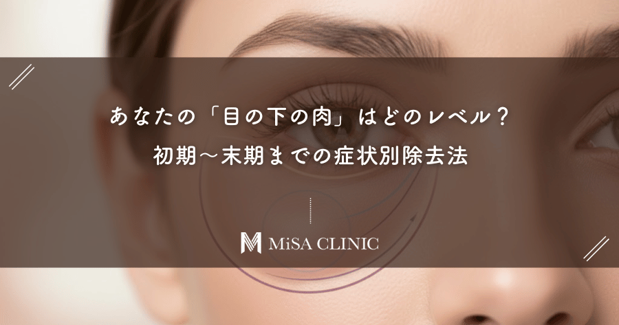 あなたの「目の下の肉」はどのレベル？初期〜末期までの症状別除去法