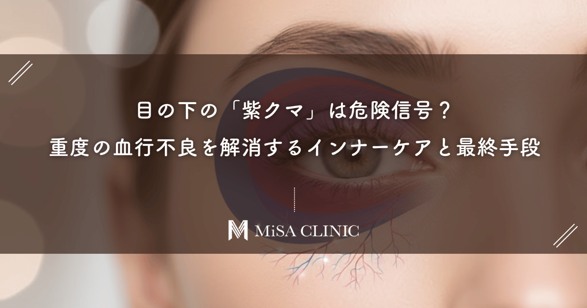 目の下の「紫クマ」は危険信号?重度の血行不良を解消するインナーケアと最終手段