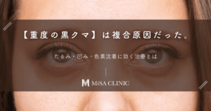 【重度の黒クマ】は複合原因だった。たるみ・凹み・色素沈着に効く治療とは