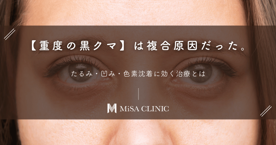 【重度の黒クマ】は複合原因だった。たるみ・凹み・色素沈着に効く治療とは