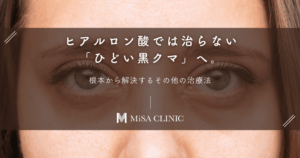ヒアルロン酸では治らない「ひどい黒クマ」へ。根本から解決するその他の治療法