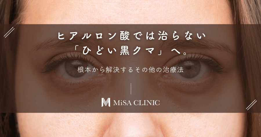 ヒアルロン酸では治らない「ひどい黒クマ」へ。根本から解決するその他の治療法