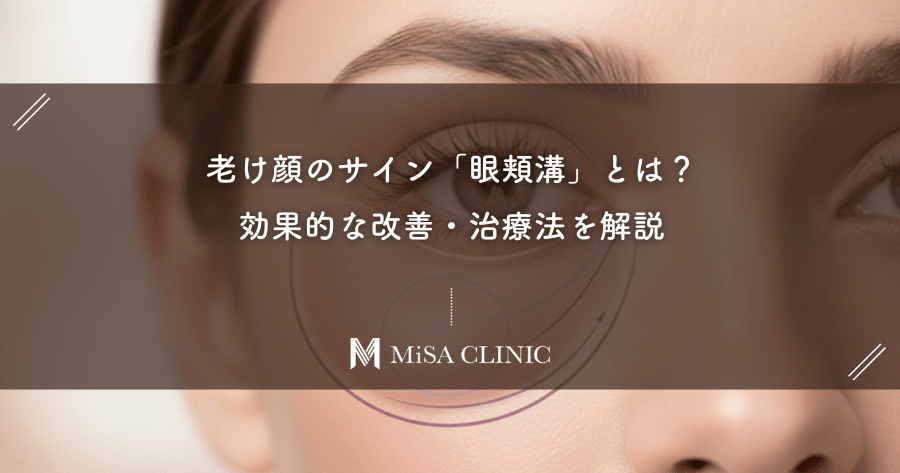 老け顔のサイン「眼頬溝」とは？効果的な改善・治療法を解説