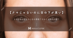 【クマじゃないのに目の下が黒い】その正体は生まれつきの骨格？それとも筋肉の影？
