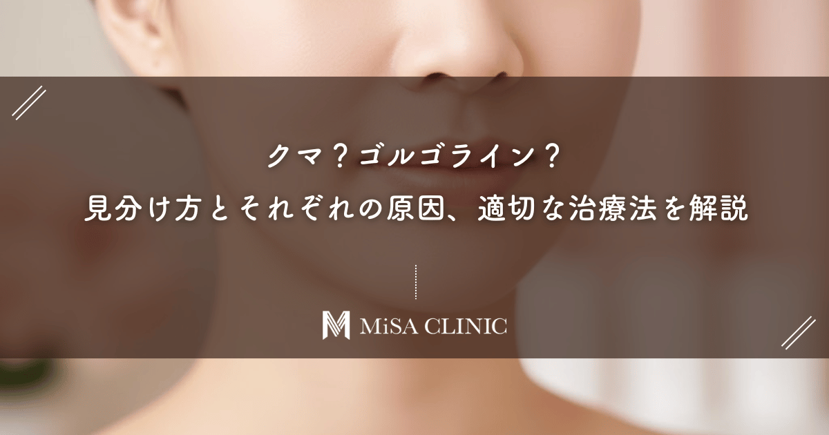 クマ？ゴルゴライン？見分け方とそれぞれの原因、適切な治療法を解説