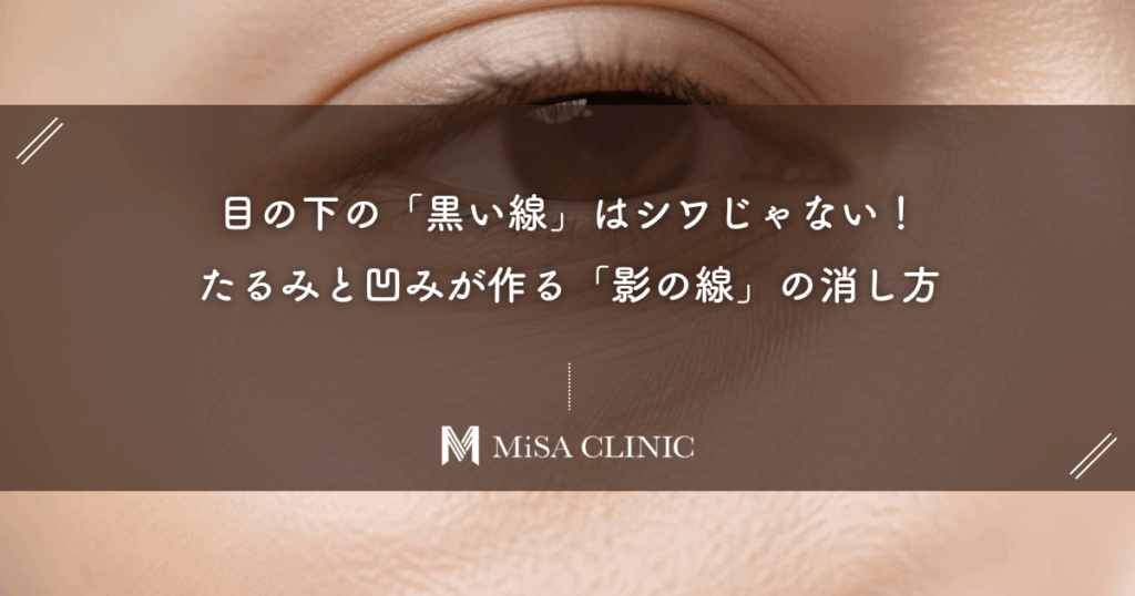 目の下の「黒い線」はシワじゃない！たるみと凹みが作る「影の線」の消し方