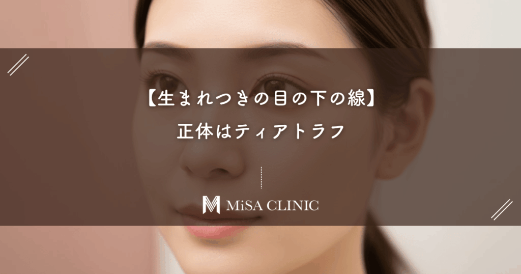 【生まれつきの目の下の線】の正体はティアトラフ。美容医療で長年の悩みを消す方法