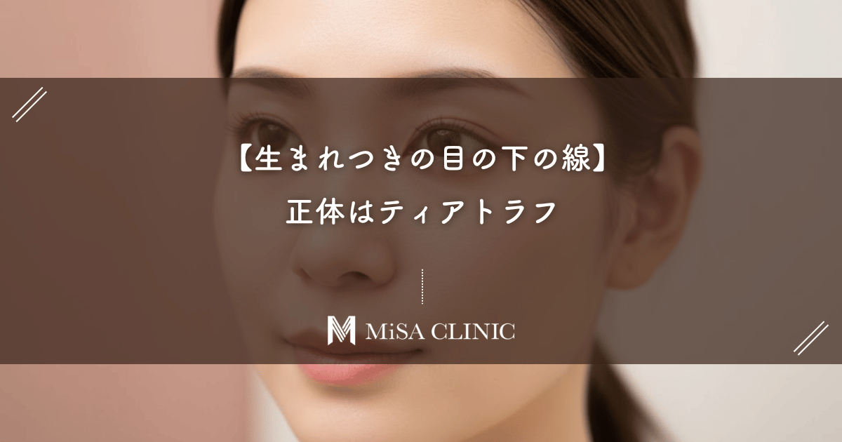 【生まれつきの目の下の線】の正体はティアトラフ。美容医療で長年の悩みを消す方法