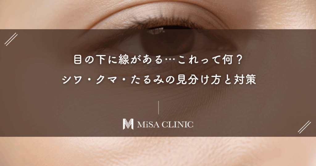 目の下に線がある…これって何？シワ・クマ・たるみの見分け方と対策