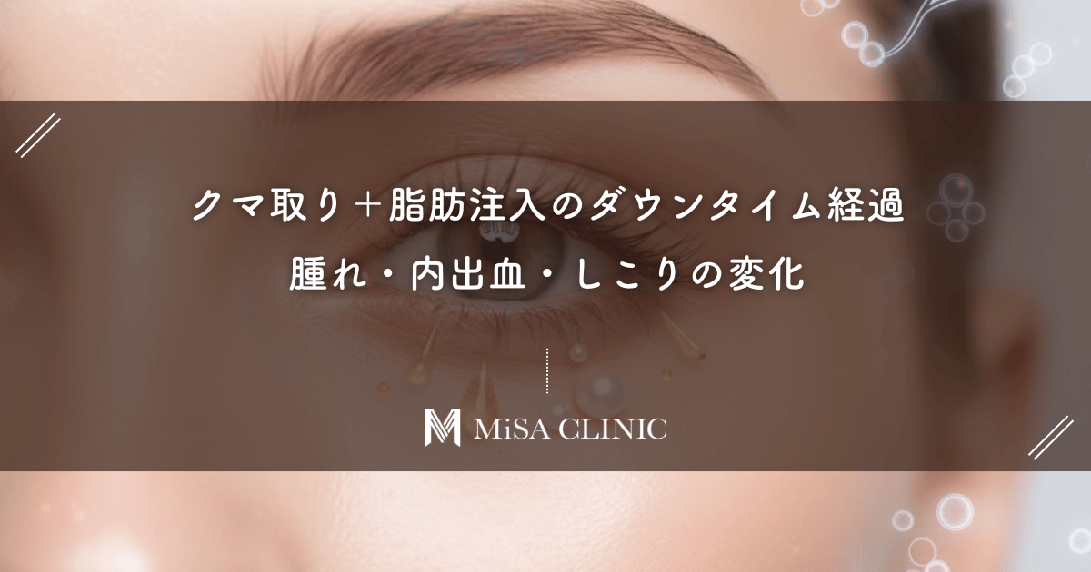 クマ取り＋脂肪注入のダウンタイム経過｜腫れ・内出血・しこりの変化