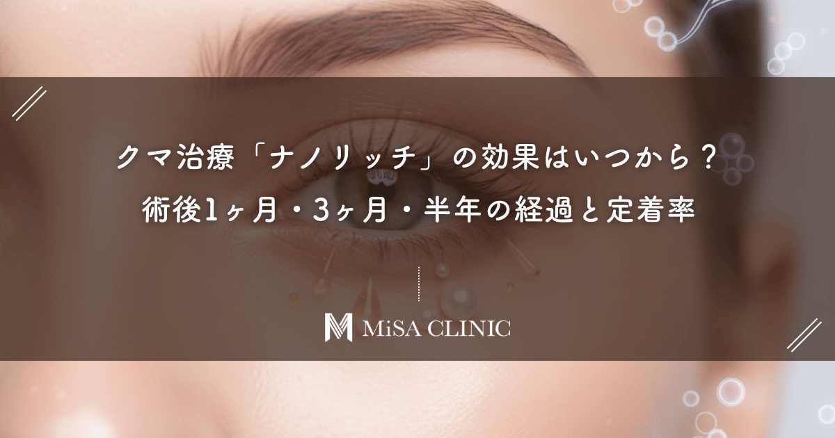 クマ治療「ナノリッチ」の効果はいつから?術後1ヶ月・3ヶ月・半年の経過と定着率