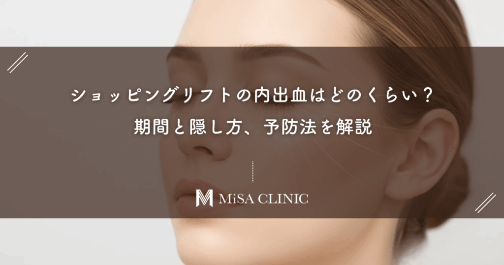 ショッピングリフトの内出血はどのくらい？期間と隠し方、予防法を解説