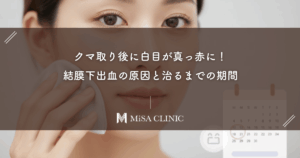 クマ取り後に白目が真っ赤に！「結膜下出血」の原因と治るまでの期間
