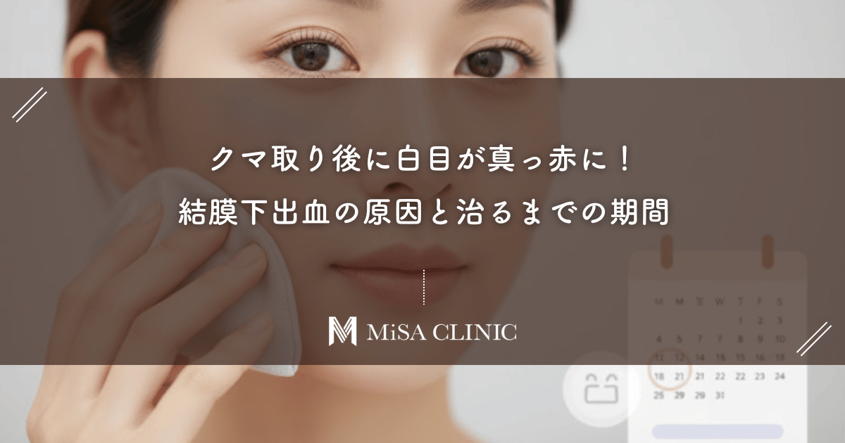 クマ取り後に白目が真っ赤に！「結膜下出血」の原因と治るまでの期間