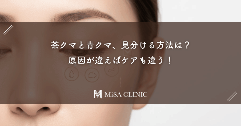 茶クマと青クマ、見分ける方法は？原因が違えばケアも違う！