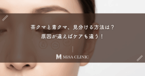 茶クマと青クマ、見分ける方法は？原因が違えばケアも違う！