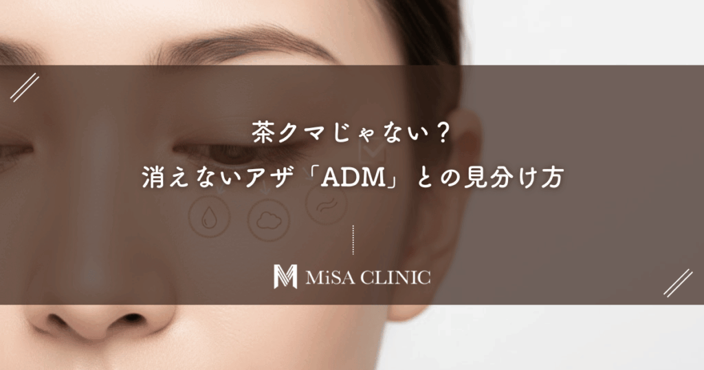 茶クマじゃない？消えないアザ「ADM（後天性真皮メラノサイトーシス）」との見分け方