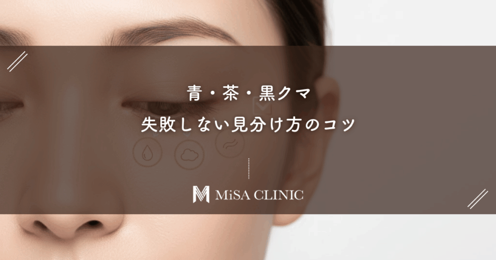 青・茶・黒クマ、失敗しない見分け方のコツを解説！あなたのクマの種類が分かる！