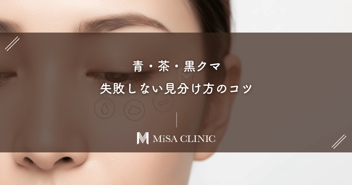 青・茶・黒クマ、失敗しない見分け方のコツを解説!あなたのクマの種類が分かる!