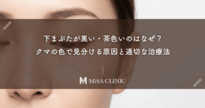 下まぶたが黒い・茶色いのはなぜ？クマの色で見分ける原因と適切な治療法