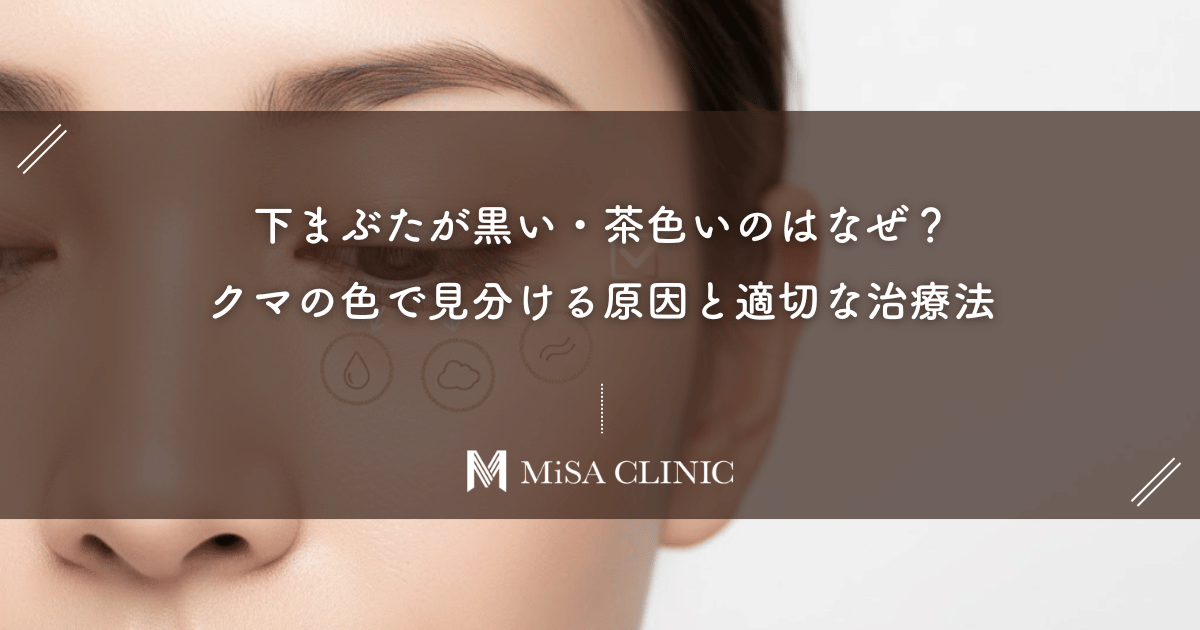 下まぶたが黒い・茶色いのはなぜ?クマの色で見分ける原因と適切な治療法