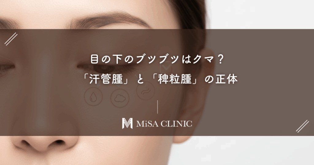 目の下のブツブツはクマ？「汗管腫（かんかんしゅ）」と「稗粒腫（はいりゅうしゅ）」の正体