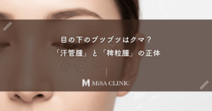 目の下のブツブツはクマ？「汗管腫（かんかんしゅ）」と「稗粒腫（はいりゅうしゅ）」の正体