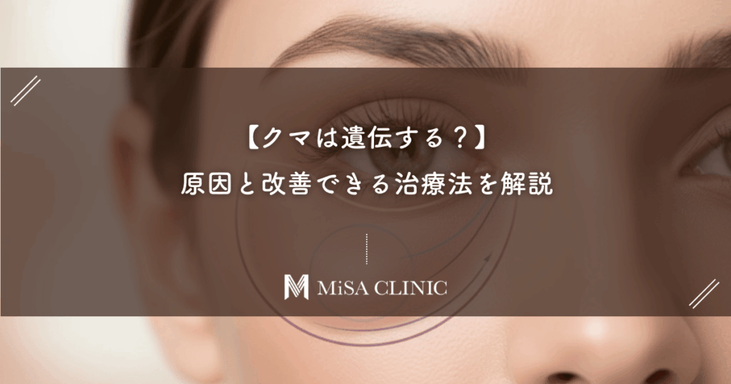 【クマは遺伝する？】生まれつきのクマを諦めないで！原因と改善できる治療法を解説