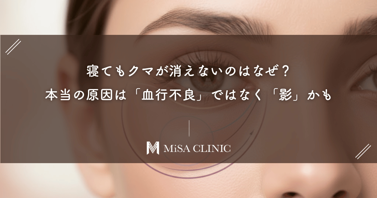 寝てもクマが消えないのはなぜ?そのクマ、本当の原因は「血行不良」ではなく「影」かも