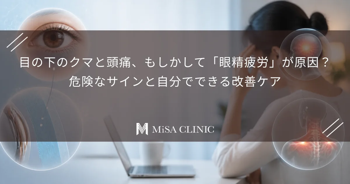 目の下のクマと頭痛、もしかして「眼精疲労」が原因？危険なサインと自分でできる改善ケア