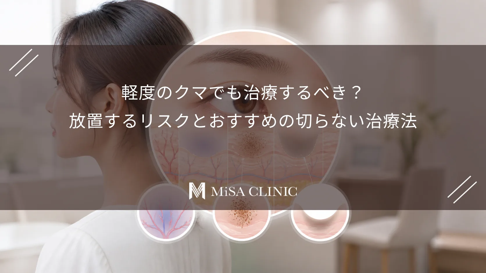 軽度のクマでも治療するべき？放置するリスクとおすすめの切らない治療法