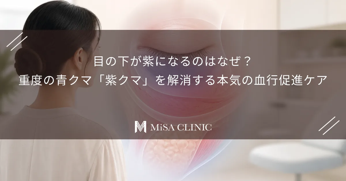 目の下が紫になるのはなぜ?重度の青クマ「紫クマ」を解消する本気の血行促進ケア