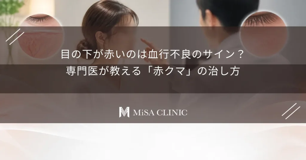 目の下が赤いのは血行不良のサイン？専門医が教える「赤クマ」の治し方